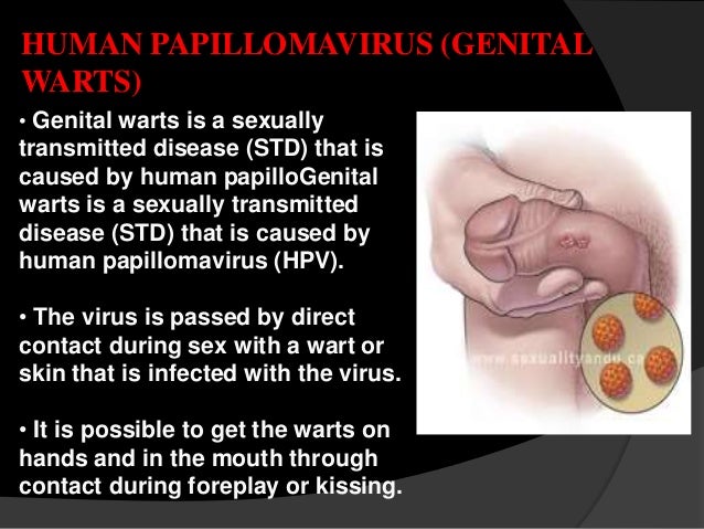 Can hpv be caught through sex